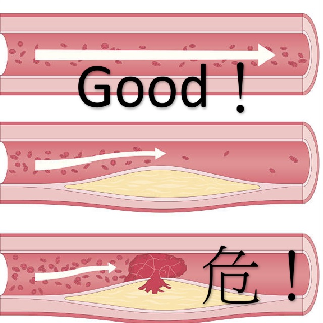 紅麴降膽固醇 降血脂 保護心血管